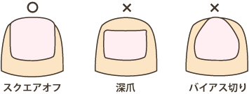 oteire03.gif